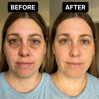 Lúmen Light™ Under-Eye Red Light Therapy