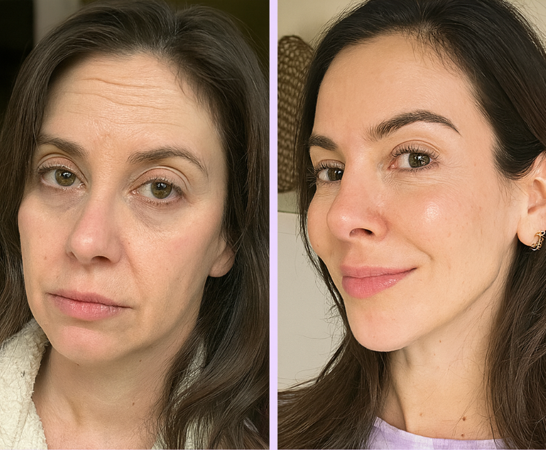 Chin & Neck Sculptor Light Therapy Device™